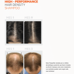 "REVITA HIGH-PERFORMANCE HAIR DENSITY SHAMPOO" with before and after images of hair regrowth.